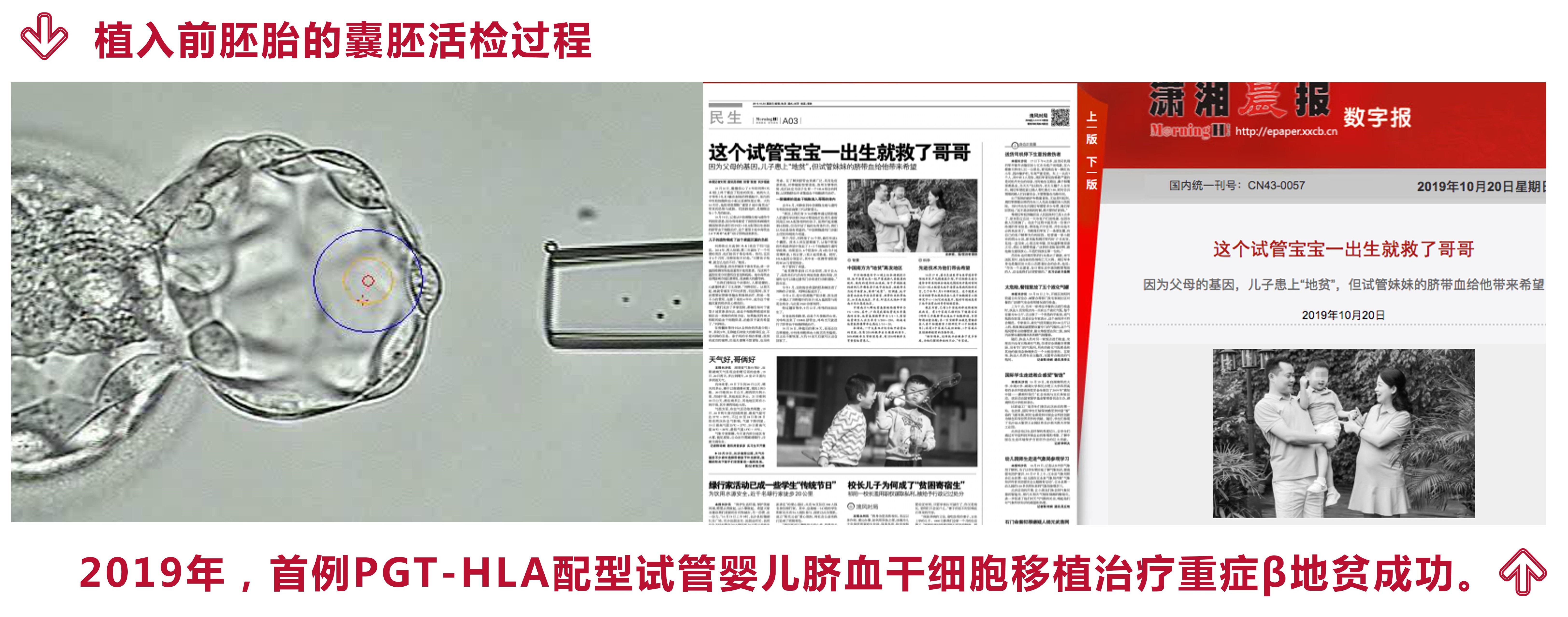 PGT-HLA治療地貧.jpg